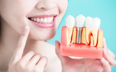 Rehabilitación, Prótesis y Estética dental