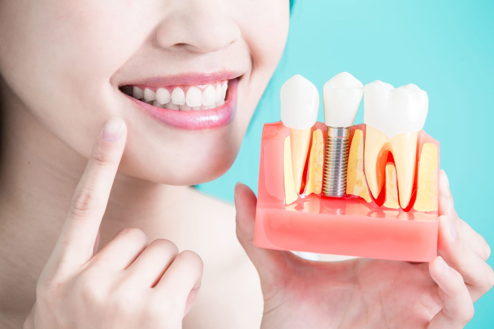 Rehabilitación, Prótesis y Estética dental